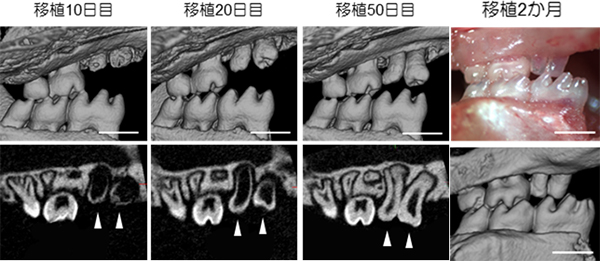 分割歯胚の口腔内移植後の経過像の図