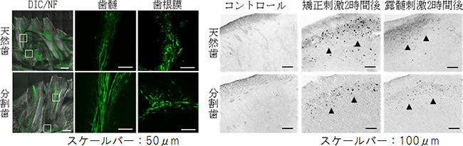 神経侵入の解析および侵害刺激の中枢への伝達機能の解析の図