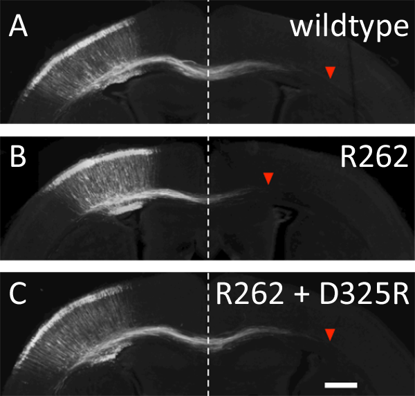 photos showing the rescue of axonal growth