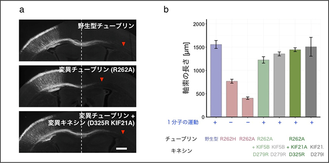 マウス脳梁の発達への変異チューブリン、変異キネシンの影響の図