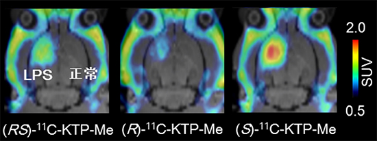 LPS脳内注入ラットにおける11C-KTP-Meの光学異性体のPETイメージング図