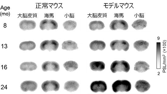 アルツハイマー型認知症モデルマウスの脳におけるオートラジオグラフィー像の図