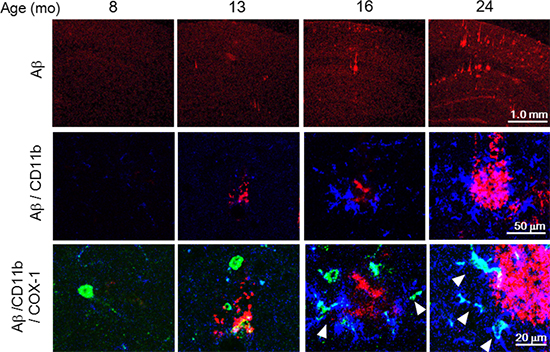 アルツハイマー型認知症モデルマウス脳におけるAβプラーク形成と活性化ミクログリアの図
