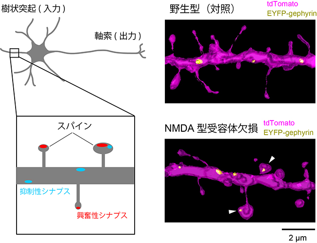 マウス脳のNMDA型グルタミン酸受容体（NMDAR）欠損神経細胞のシナプス形態の解析図