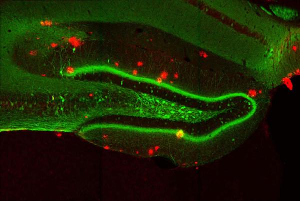 fluorescence imaging - engram cell in the dentate gyrus of AD mouse