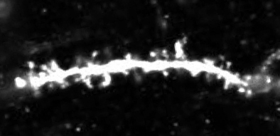 photo of spines on an engram cell in the dentate gyrus