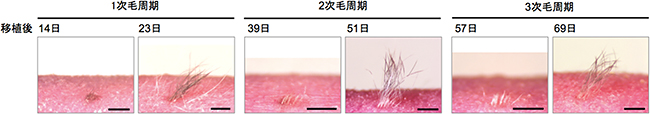 移植した再生毛包の毛周期の解析の図