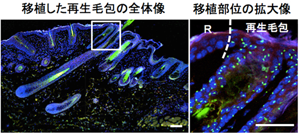 皮下移植したY染色体を持つ再生毛包の組織解析の図