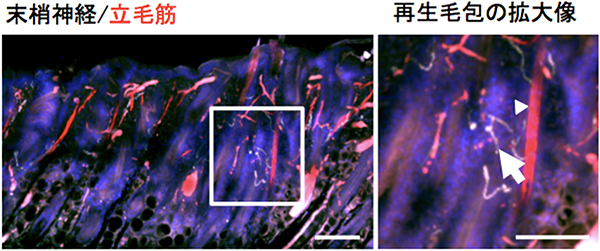 再生毛包の立毛筋に接続したレシピエントの神経の図