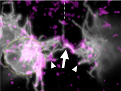 ショウジョウバエ胚の気管先端細胞における細胞突起同士の接触の図