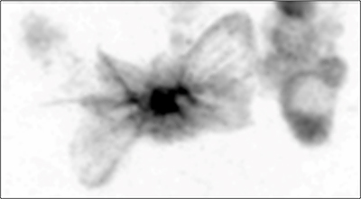 ショウジョウバエ胚の接着した先端細胞の図