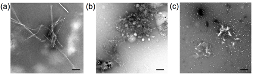 images of Aβ40 aggregation