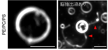 マウスの脳抽出液によるリポソームのチューブ状膜構造形成の暗視野顕微鏡画像の図