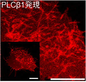 マウス培養細胞におけるPLCβ1によるチューブ状膜形成の蛍光顕微鏡画像の図