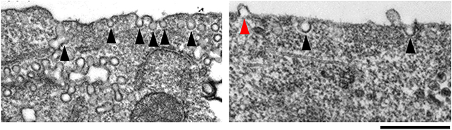 マウス培養細胞におけるPLCβ1の発現阻害の影響を表した電子顕微鏡画像の図