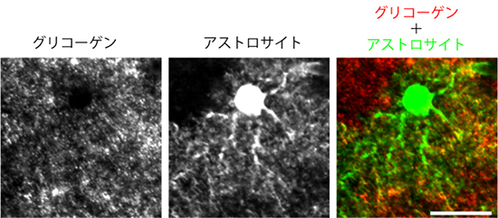 マウス脳のグリコーゲンとアストロサイトの光学顕微鏡写真の画像