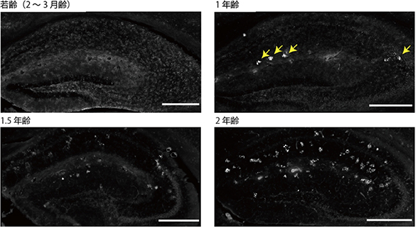 海馬における若齢マウスと老齢マウスのグリコーゲンの図