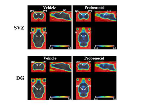 PET images of tracer accumulation