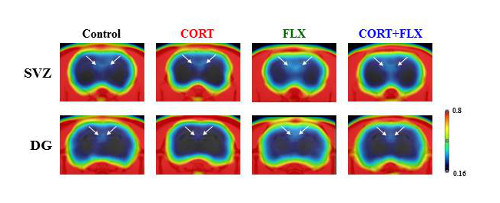 PET images showing decreased neurogenesis