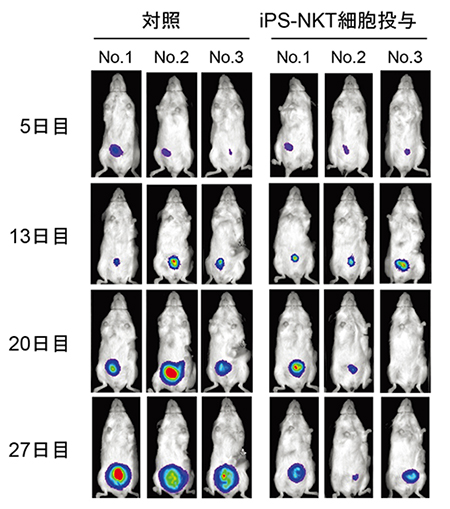 マウスの生体内でのiPS-NKT細胞による抗腫瘍細胞効果の図