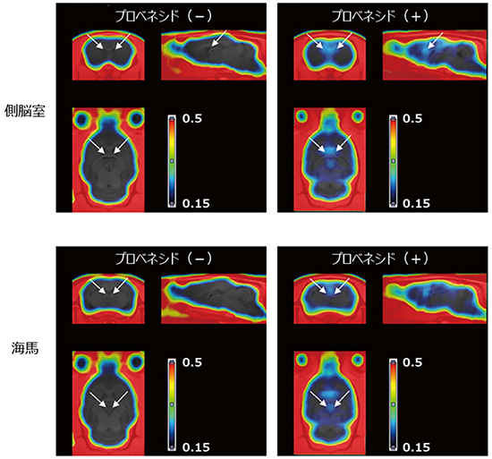 PETによるラット脳での [18F]FLT集積量の観察の図