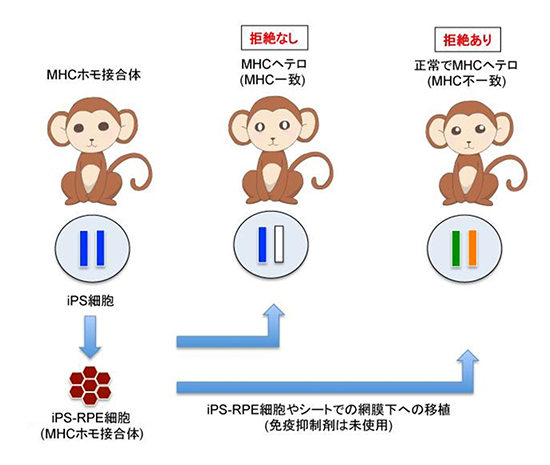 サル個体を用いたMHCホモ接合体iPS細胞由来RPE細胞の他家移植と拒絶反応の図