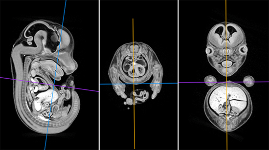 マウスE14.5日胚micro-CTイメージング（多断面再構成）の図