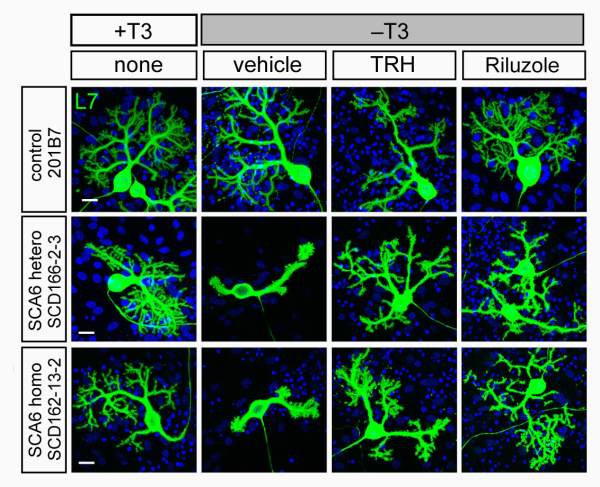 fluorescence imaging -  effect of drug treatment on purkinje cells