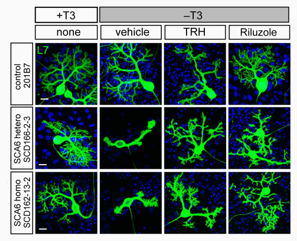 fluorescence imaging - effect of drug treatment on purkinje cells