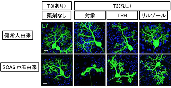 甲状腺ホルモンT3の有無によるプルキンエ細胞の形態変化の図