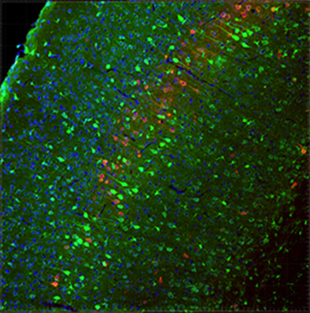 HITIによる成体マウス脳のゲノム編集の図