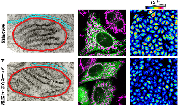 正常な細胞とアービット欠損細胞の小胞体-ミトコンドリア接触部位とCa<sup>2＋</sup>濃度の比較の図