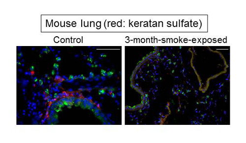 imaging showing smoking reduces keratan sulfate