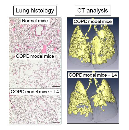 images of COPD damage reduced by L4 treatment