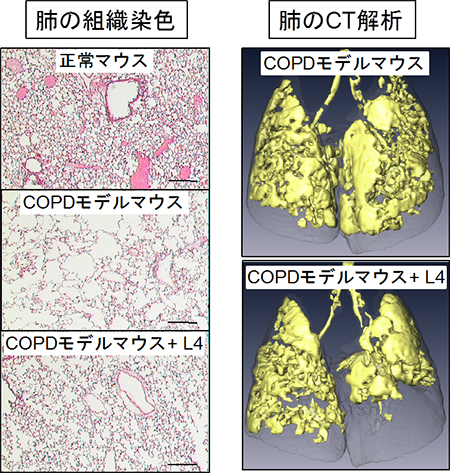 L4によるCOPD抑制効果の図