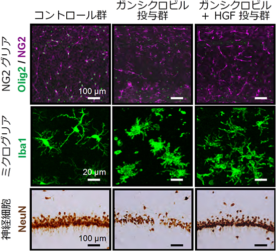 肝細胞増殖因子（HGF）による神経炎症の抑制と神経細胞の保護の図