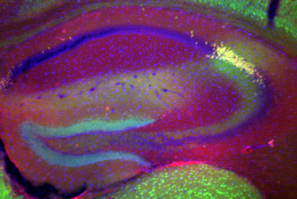 Image showing Cre recombinase expression in CA2 pyramidal cells