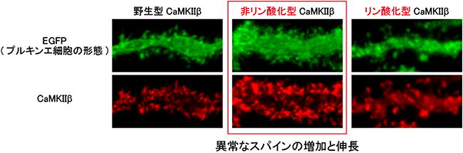 非リン酸化CaMKIIβによるプルキンエ細胞のスパインの異常な増加と伸長の図