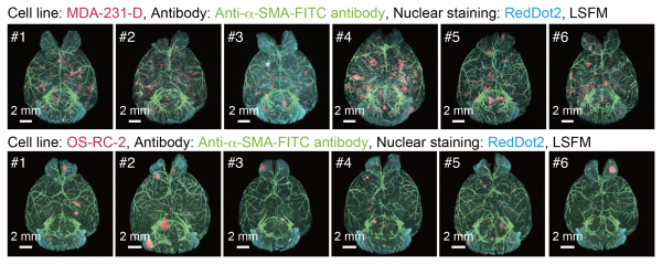 Images showing 3D analysis of the metastatic patterns in experimental brain metastasis models
