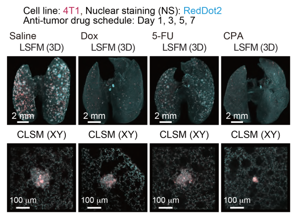 Images showing therapeutic effects of anti-tumor drugs in an experimental lung metastatic model