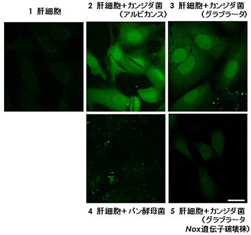 肝細胞とカンジダ菌との共培養系における活性酸素の産生の図