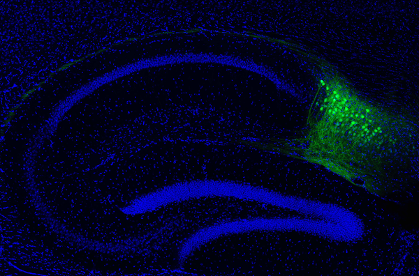 Image showing genetic tagging of subiculum neurons