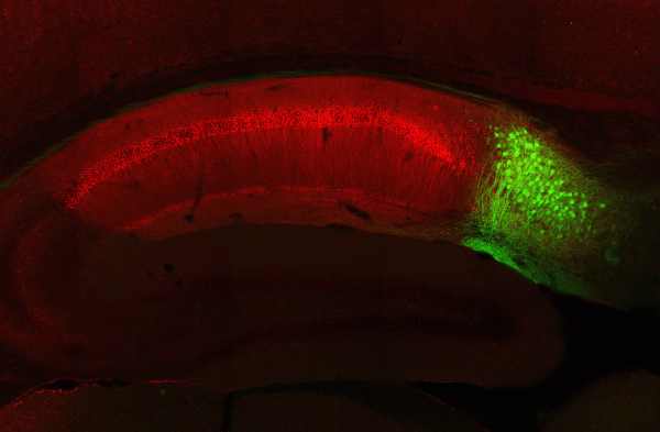 Image showing CA1 and subiculum neurons