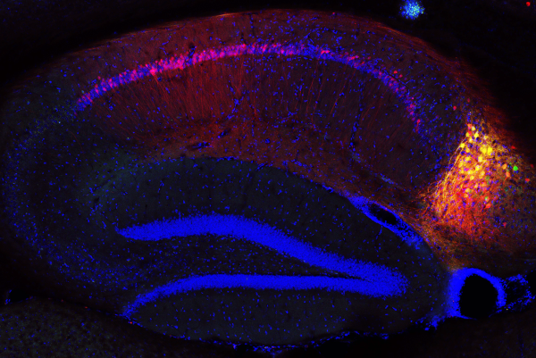 Image showing inputs to subiculum neurons