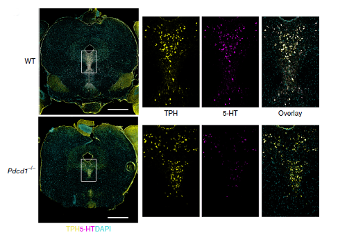 Serotonin and dopamine in the hippocampus