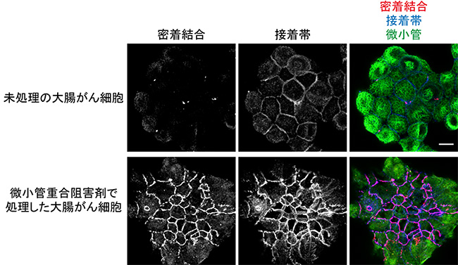 微小管重合阻害剤で大腸がん由来細胞株の接着が回復の図