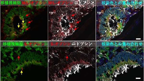NOG-rd1に移植したヒトES細胞由来網膜の成熟の図