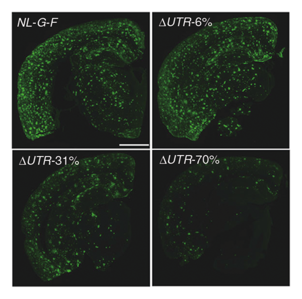images of A-beta accumulation in mice
