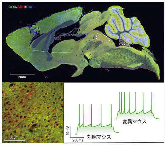 Ant1変異マウスの脳切片の染色像とセロトニン神経細胞の活動の図