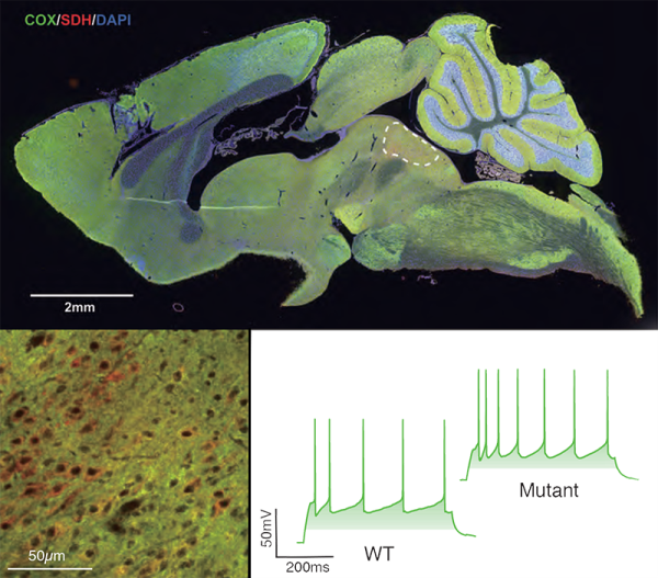 Image of rat brain showing COX expression